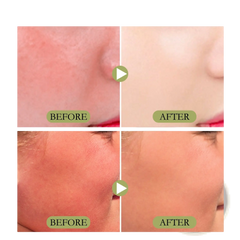 Matte Sun Stick Spf 50 Moisturizing Skincare Cream